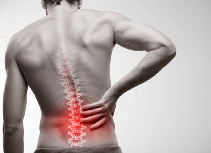How X-Rays Help Diagnose Back Pain